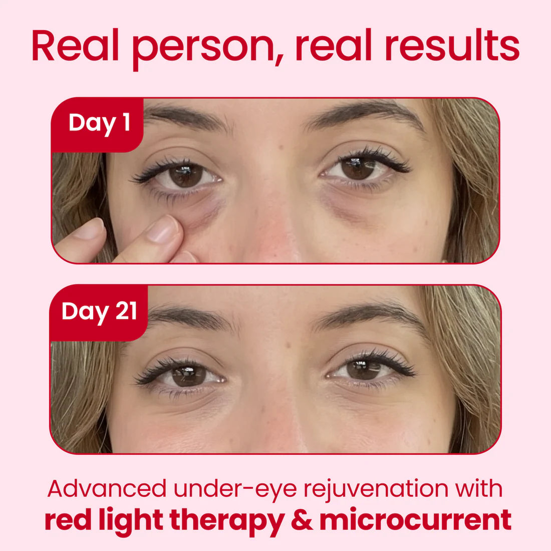 GlowlyLens Red Light + Microcurrent Eye Glasses
